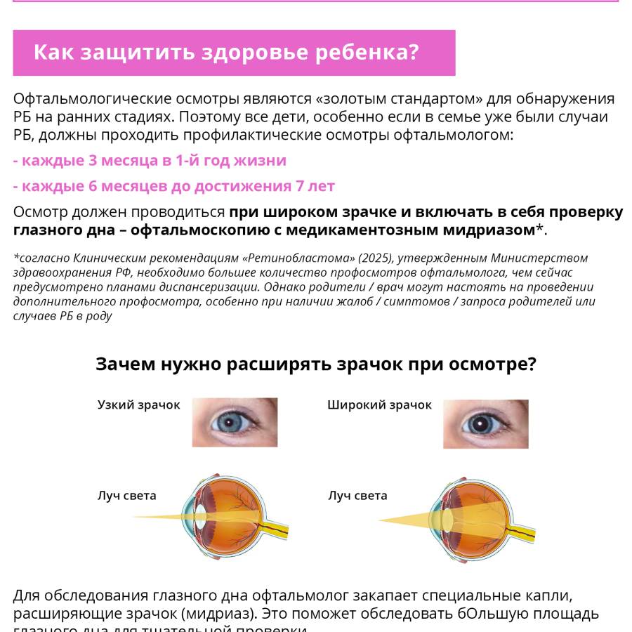Ретинобластома. Что это? И как её вовремя распознать?